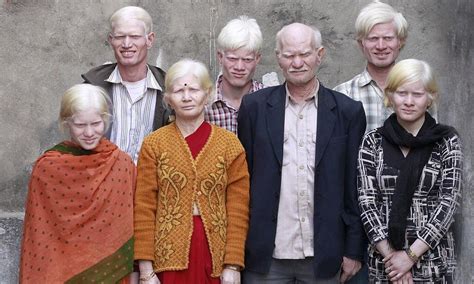 indian albinos